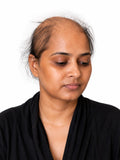 18", Medical Wigs for Alopecia & Cancer Patients